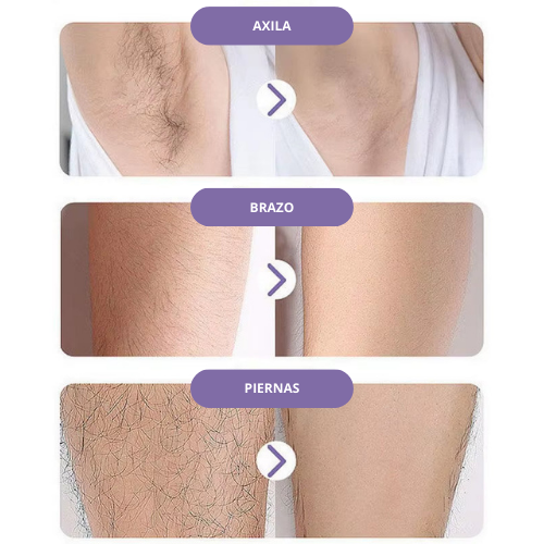 Uverio – Depilador Indoloro